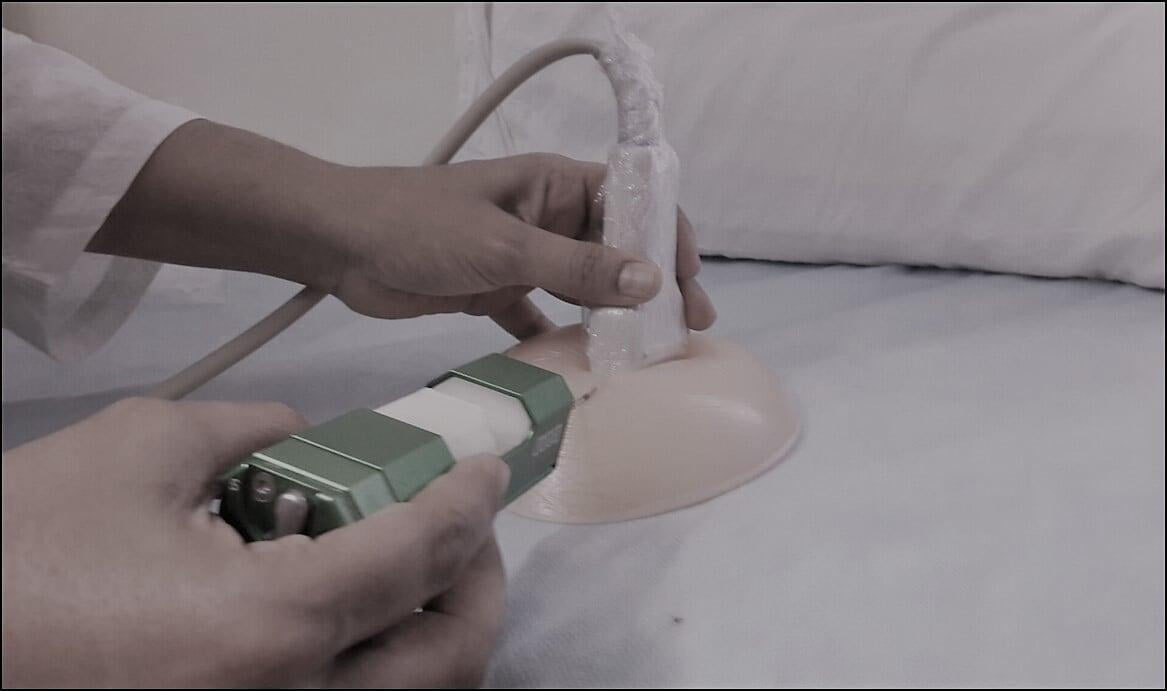 Ultrasound Slate Chennai Breast Centre